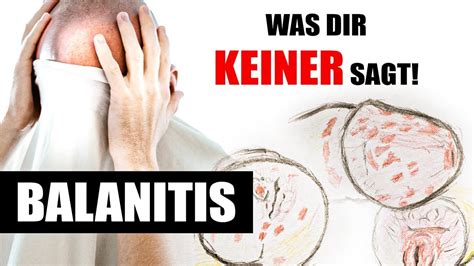 peniskrankheiten|Balanitis: Entzündung der Eichel 